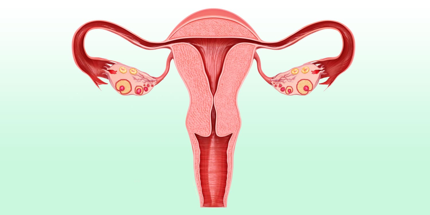 Post-tubal ligation syndrome Women discuss side effects of getting tubes tied picture image