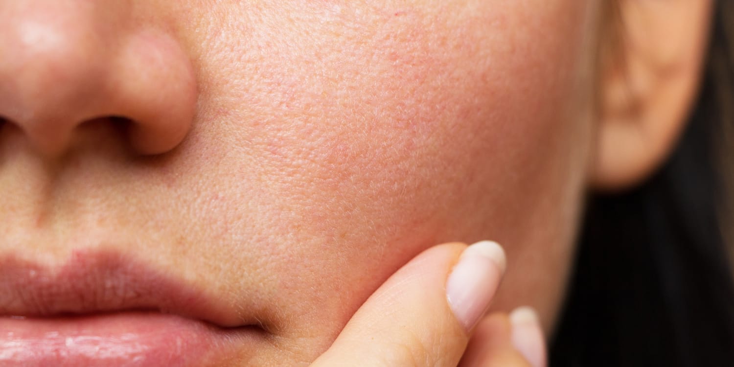 what are skin allergy 10 tips to recover