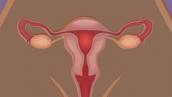 Uterine fibroids symptoms and treatment: What to know