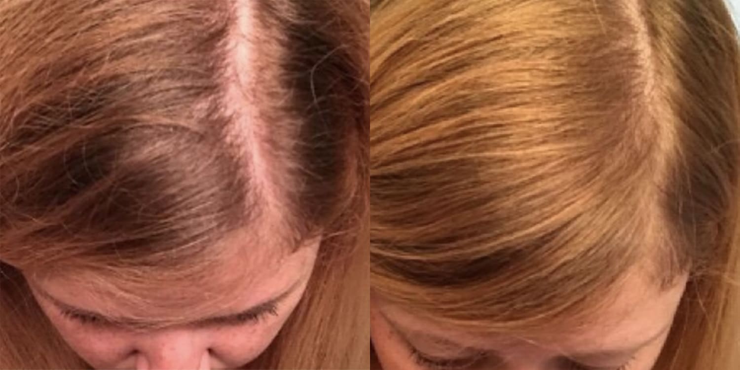 People are loving this affordable hair-lightening spray