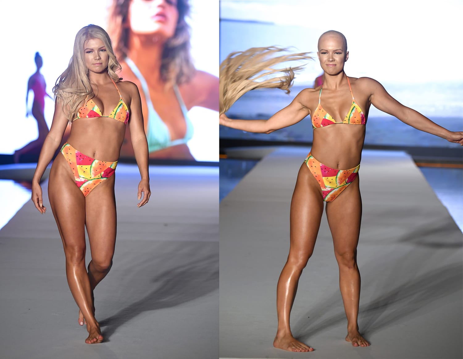Sports Illustrated model with alopecia pulls off her wig on the runway