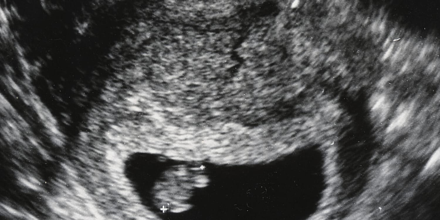 беременность 11 недель грудь фото 62