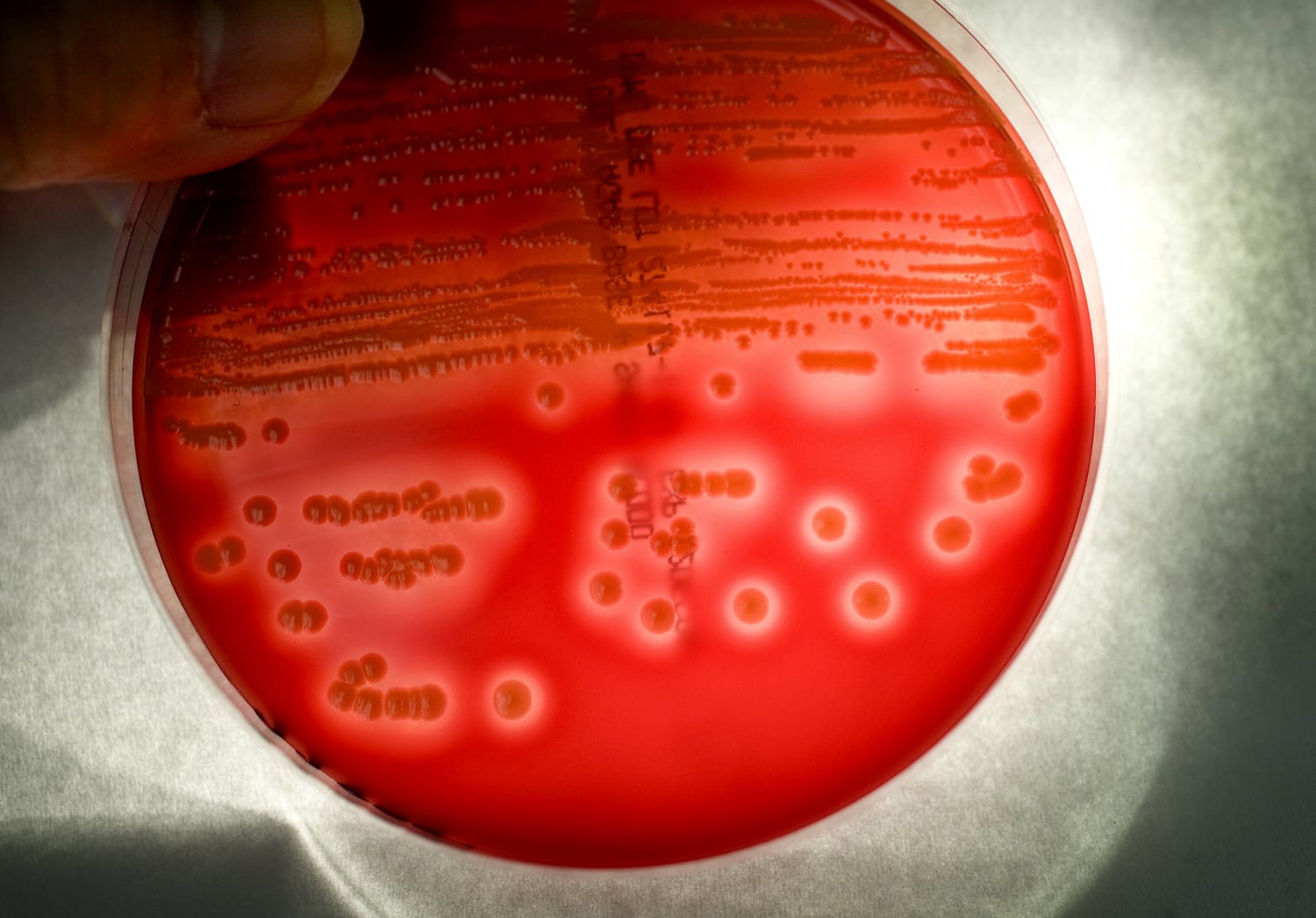 mrsa bacteria