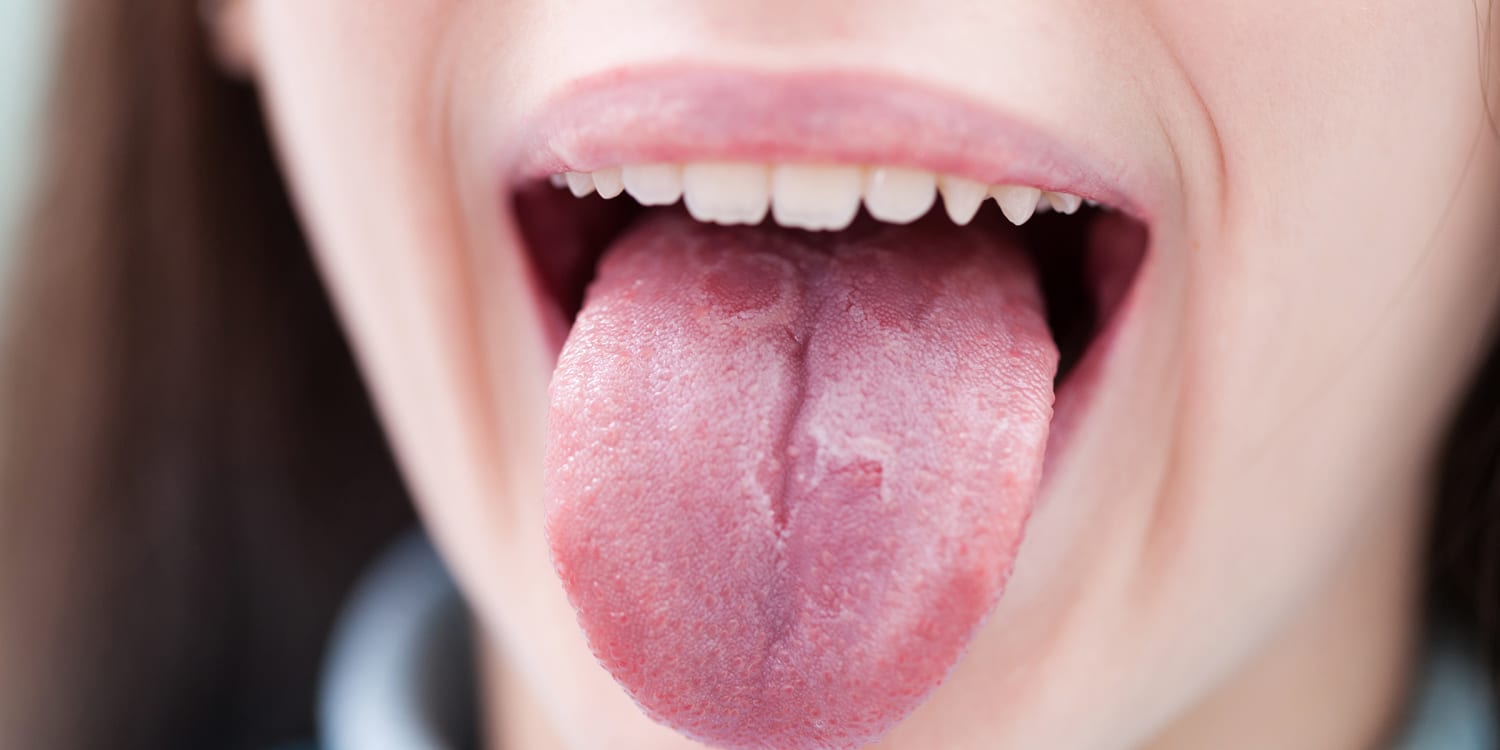 white coating over tongue