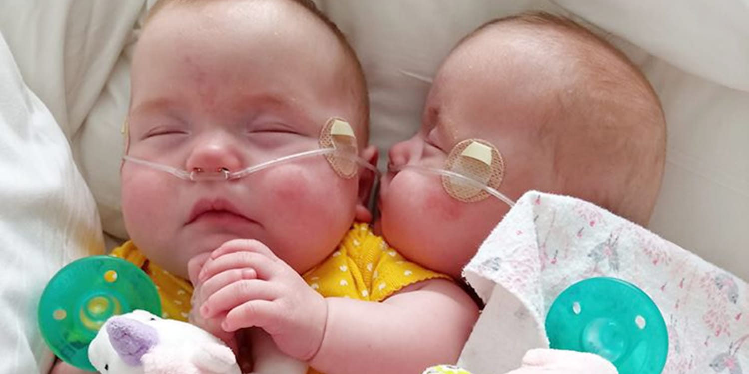 Born At 22 Weeks Twin Micropreemies Among Youngest To Survive