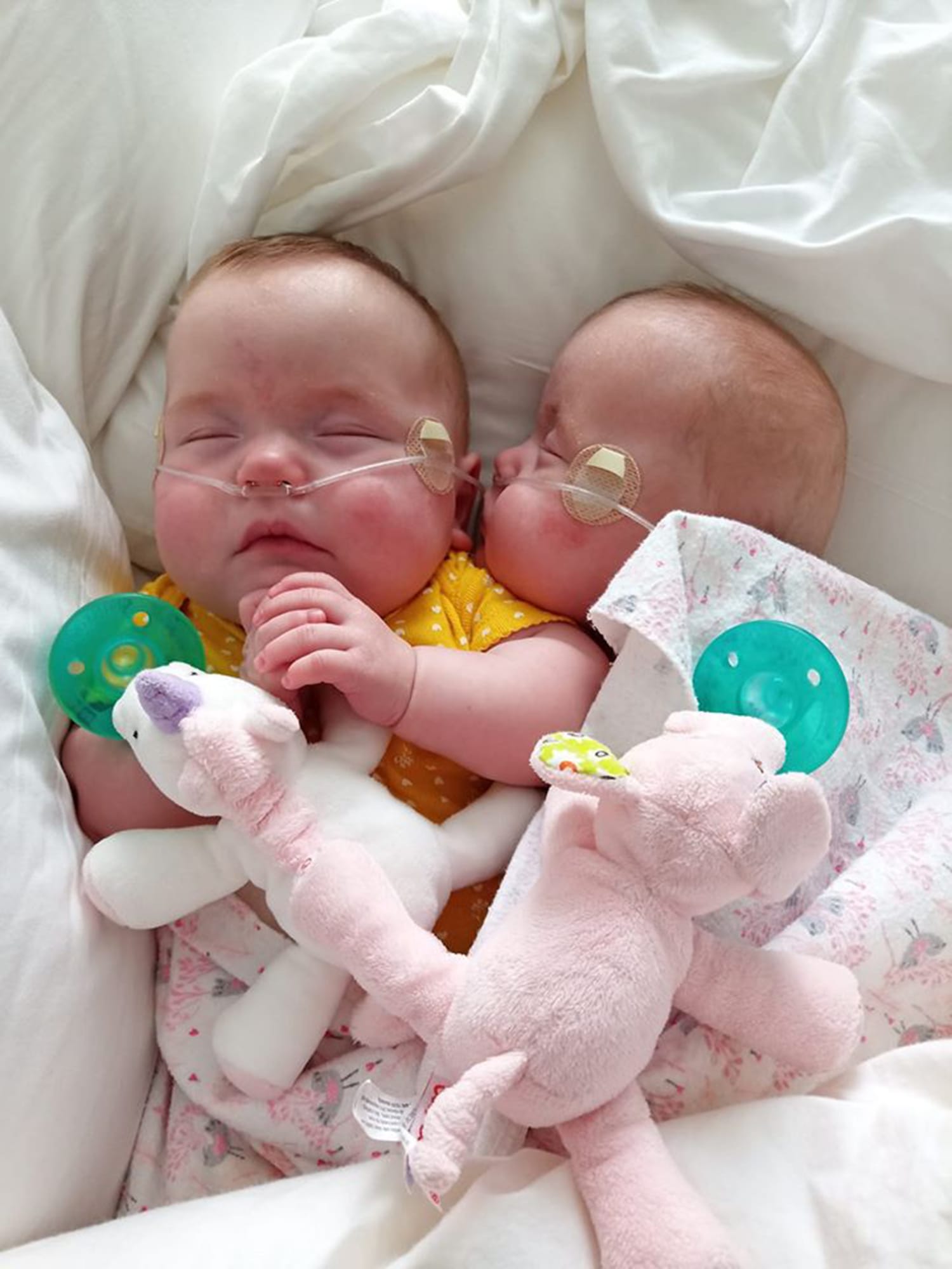Born At 22 Weeks Twin Micropreemies Among Youngest To Survive