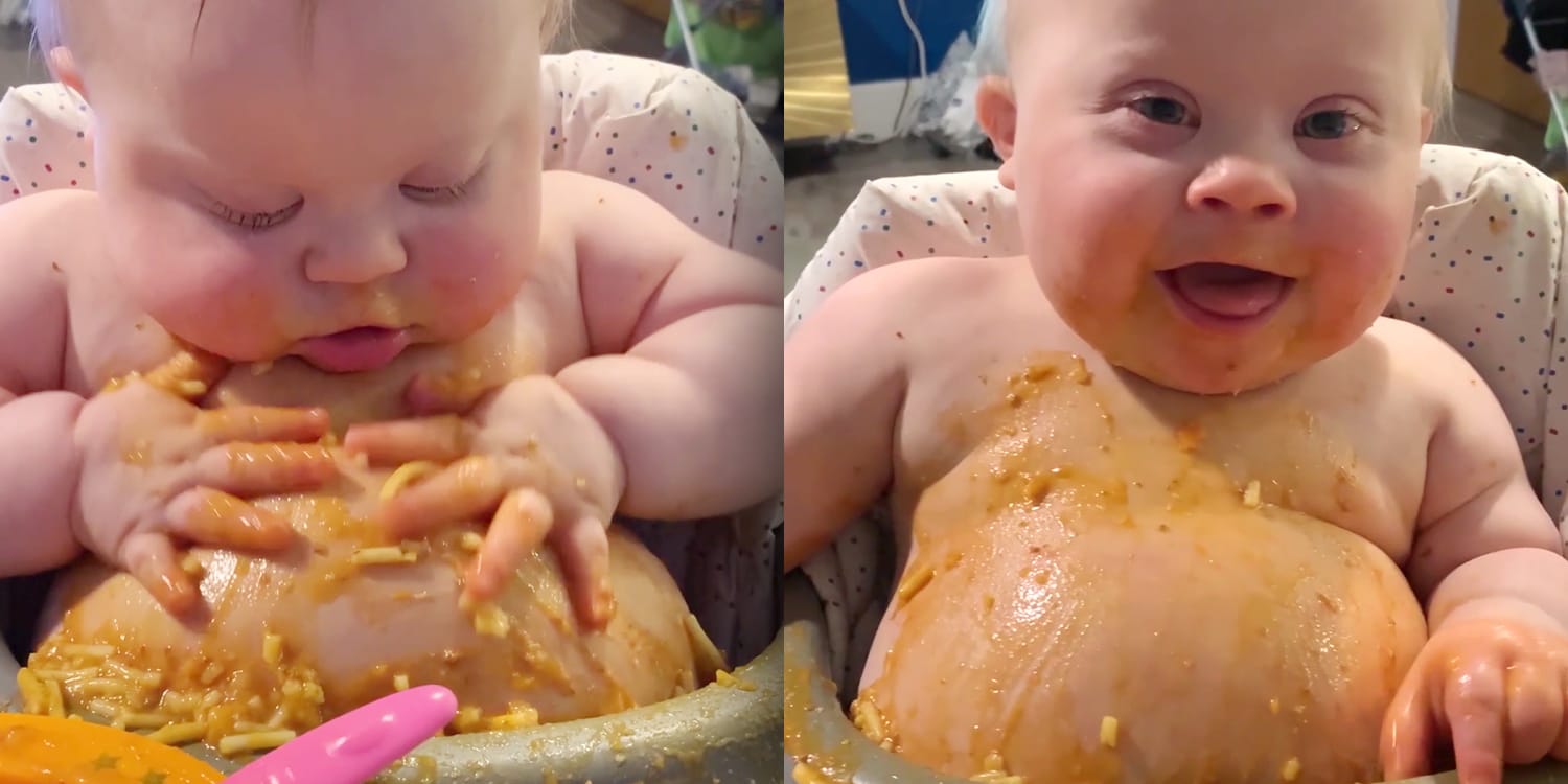 Baby With Down Syndrome Rubs Spaghetti On His Belly In Video
