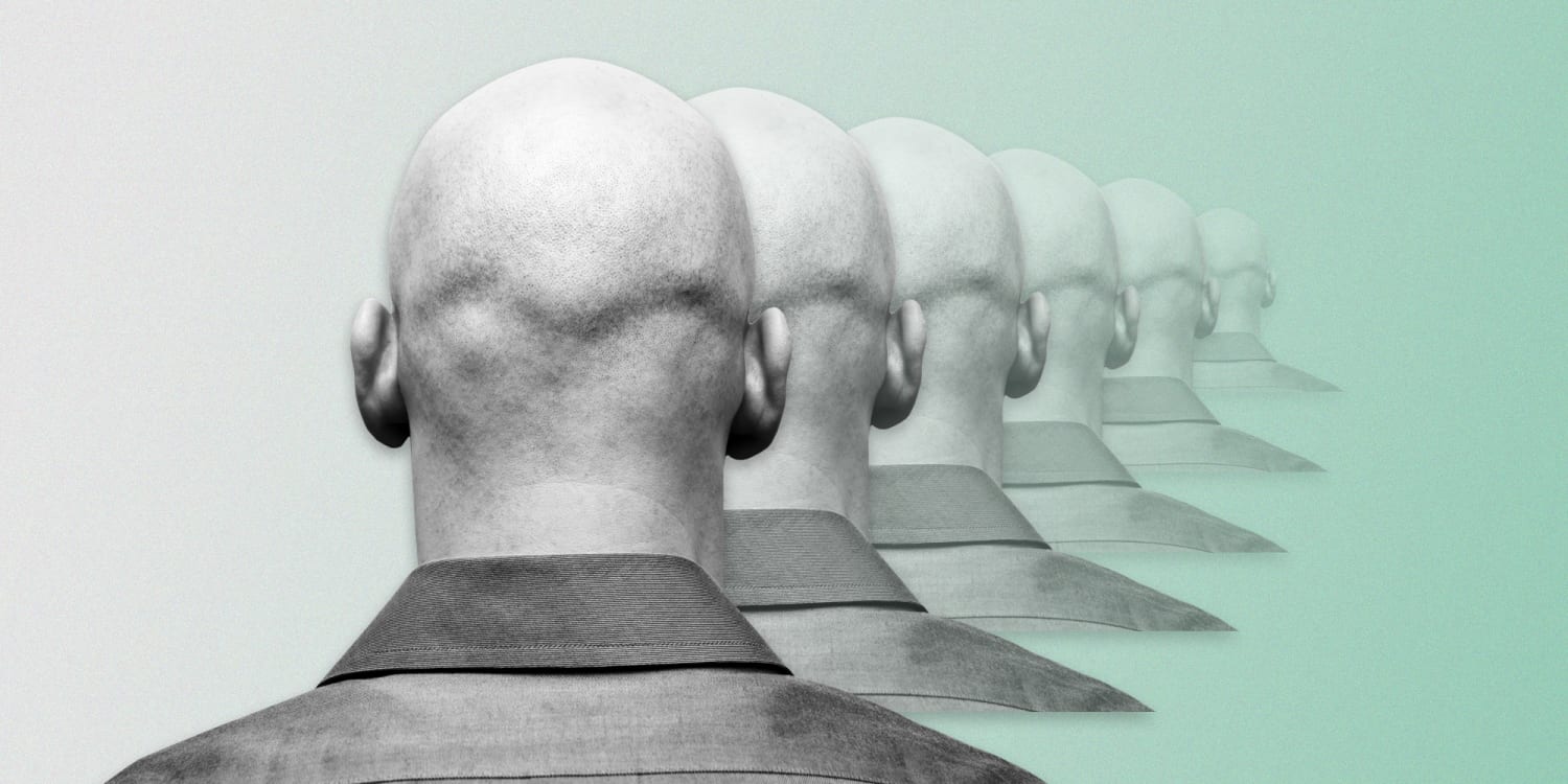 DIY coronavirus haircuts? No need when you're going bald. And that's not the only upside. DIY coronavirus haircuts? No need when you're going bald. And that's not the only upside.