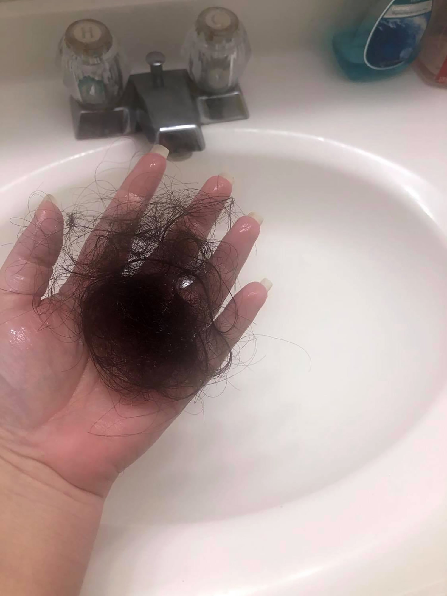hair loss in shower male