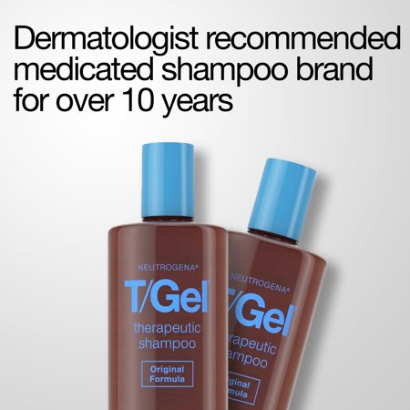How To Get Rid Of Dandruff Experts Recommend These Easy Fixes