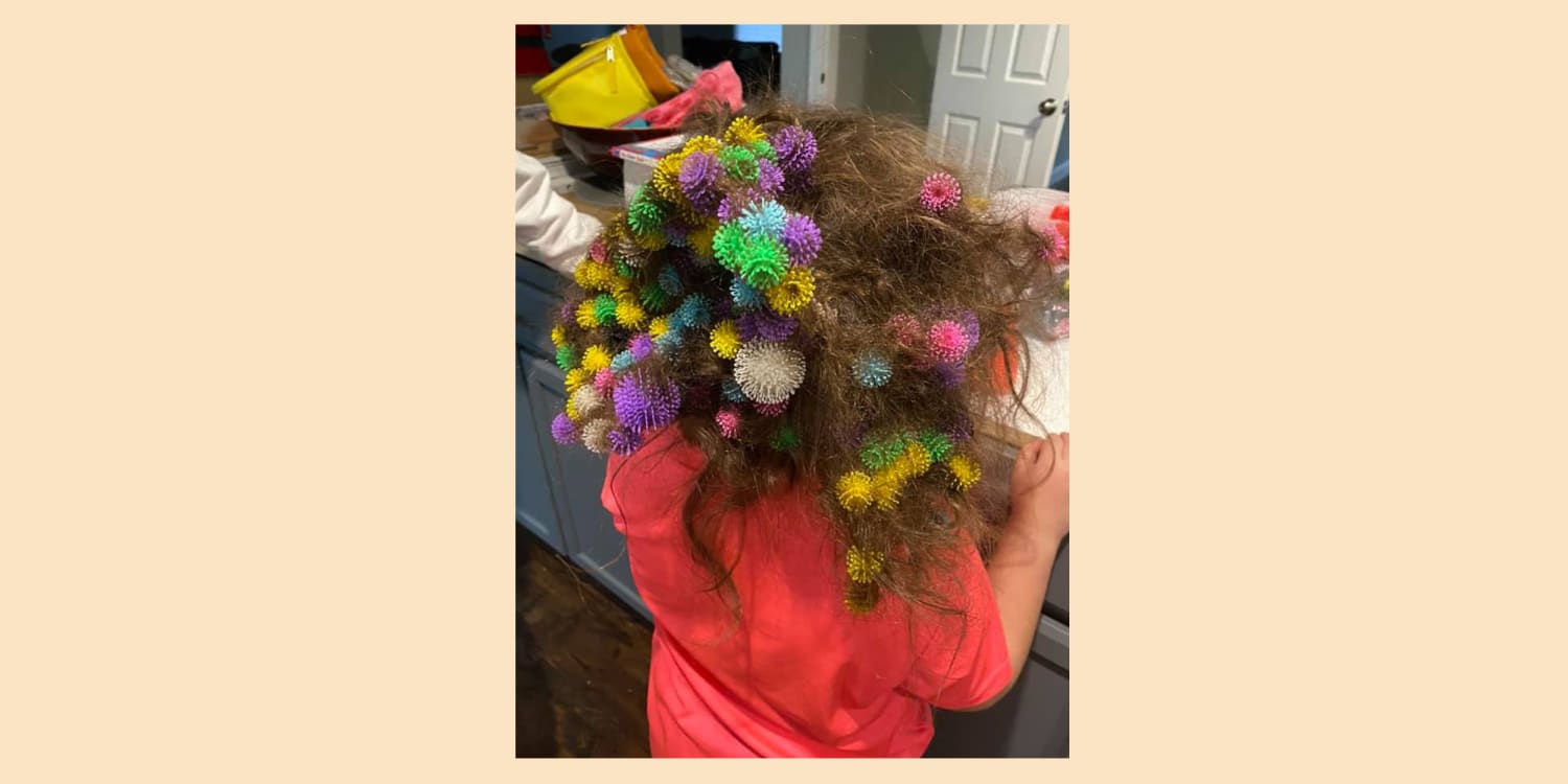Girl gets 150 Bunchem balls stuck in hair and goes viral