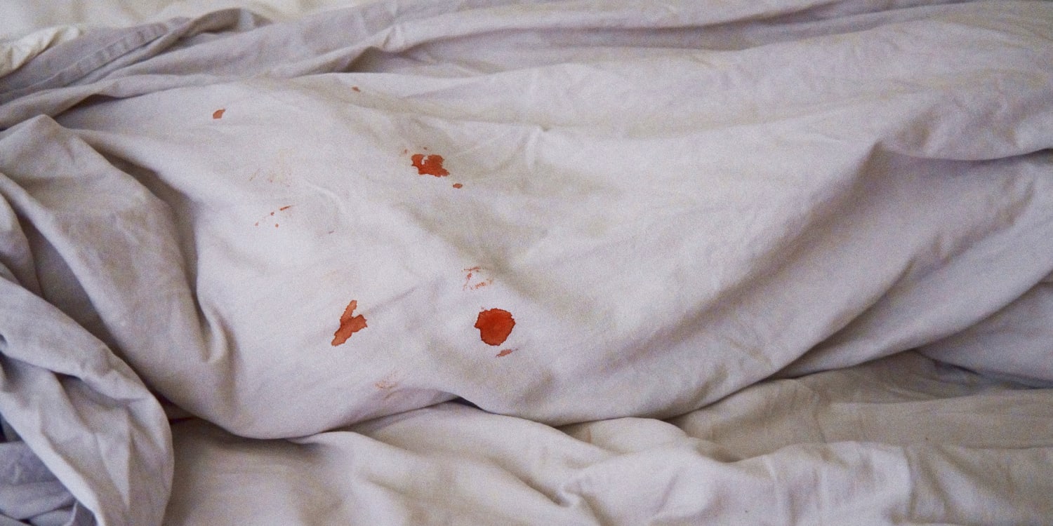 How To Remove Blood Stains From Clothes And Furniture Today