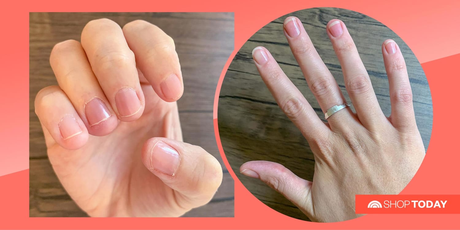 Before And After Nail Manicure High-Res Stock Photo - Getty Images