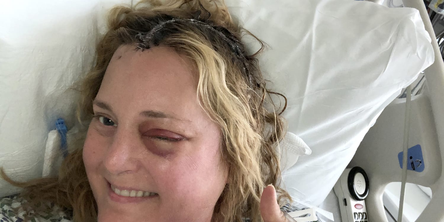 ohio anchor monica robins details brain tumor treatment