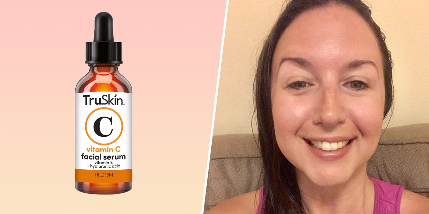 Vitamin C Serum Before and After Pictures