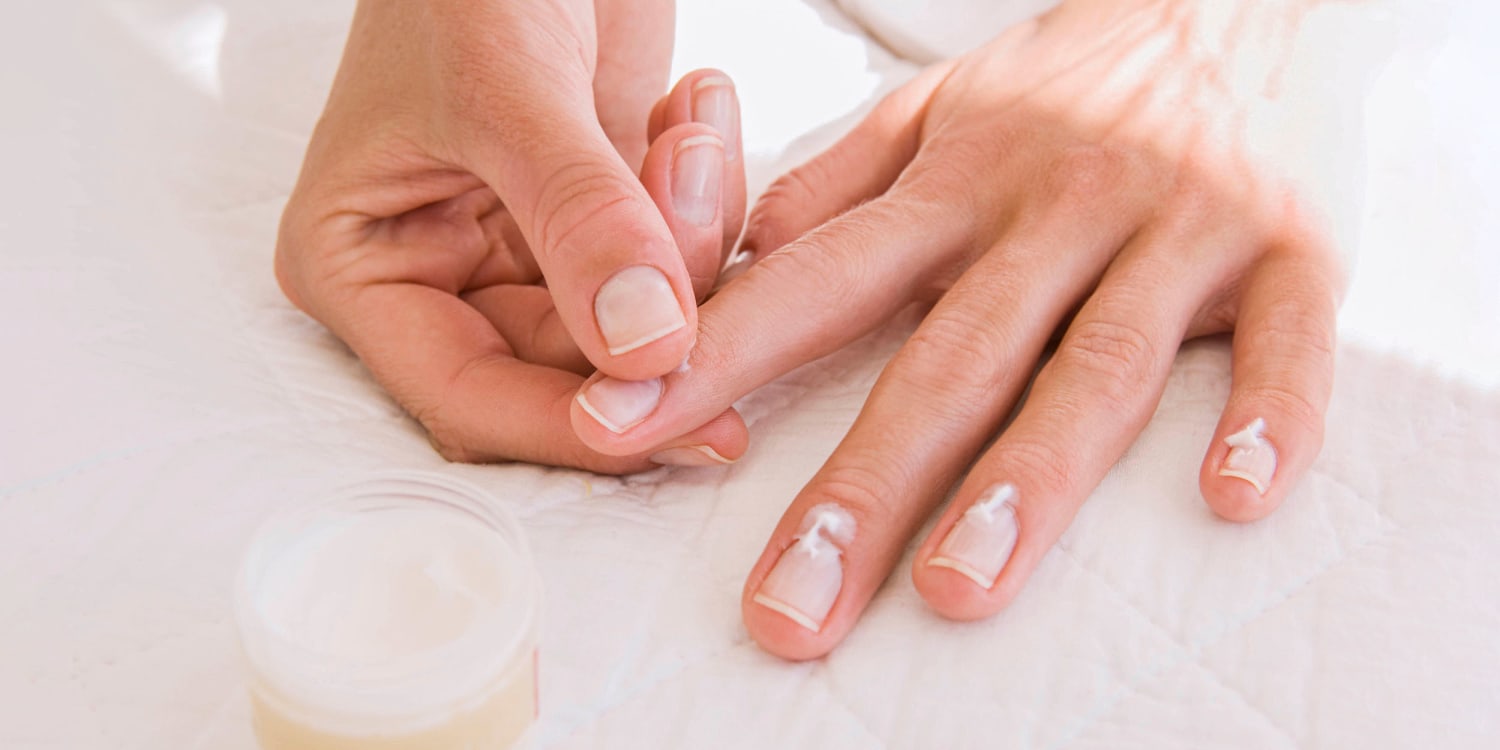 How to fix dry skin around your nails – sienna.co
