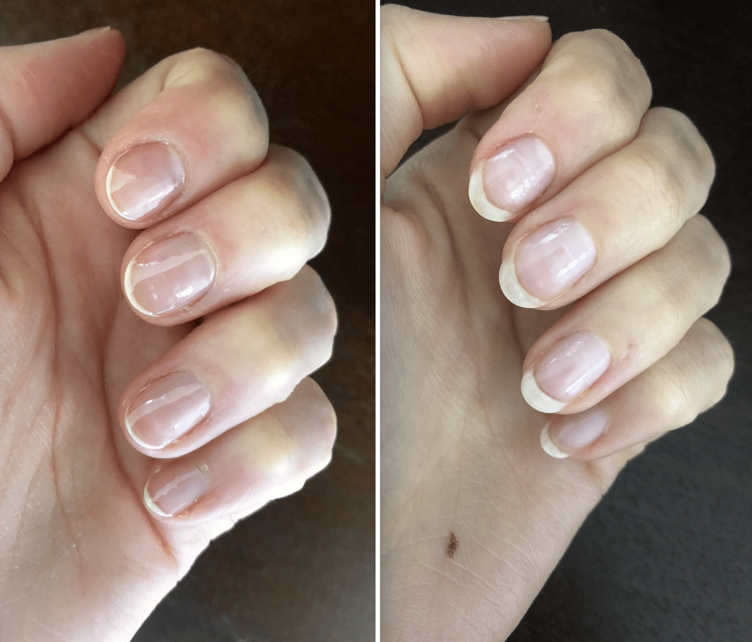 Growing Out Healthy Nails After Years of Biting? | ThriftyFun