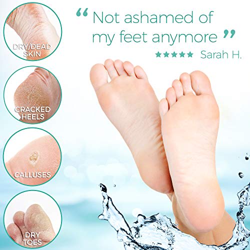 8 best foot exfoliators for smoother feet