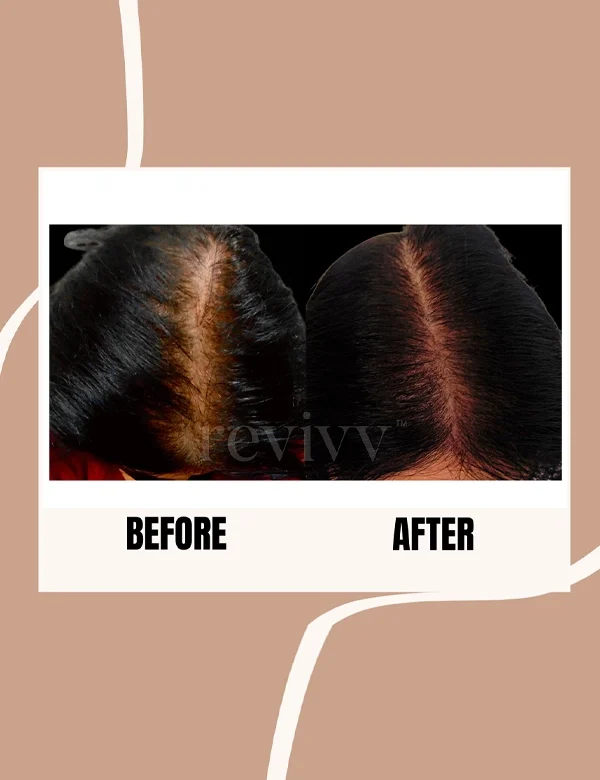 mCaffeine Coffee Scalp & Hair Oil for Boosting Hair Growth With Argan  Oil 200ml | eBay