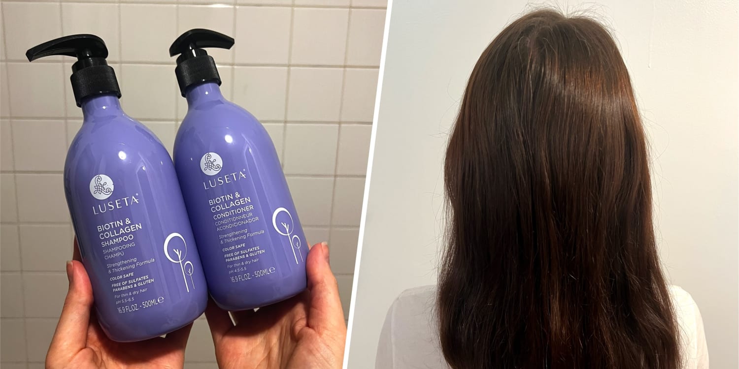 biotin before and after results