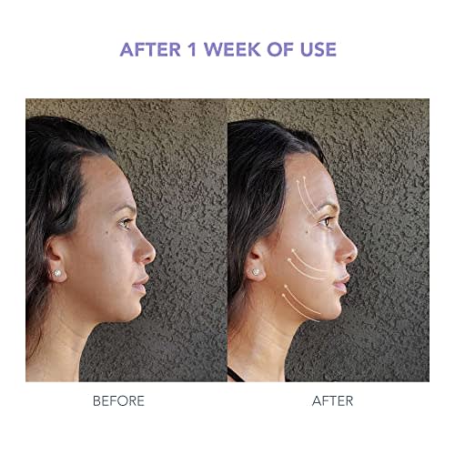 What Is A Microcurrent Facial? Microcurrent Facial Review,, 57 OFF