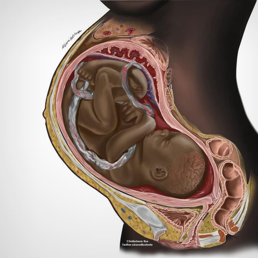 Why did one illustration of a Black fetus go viral?