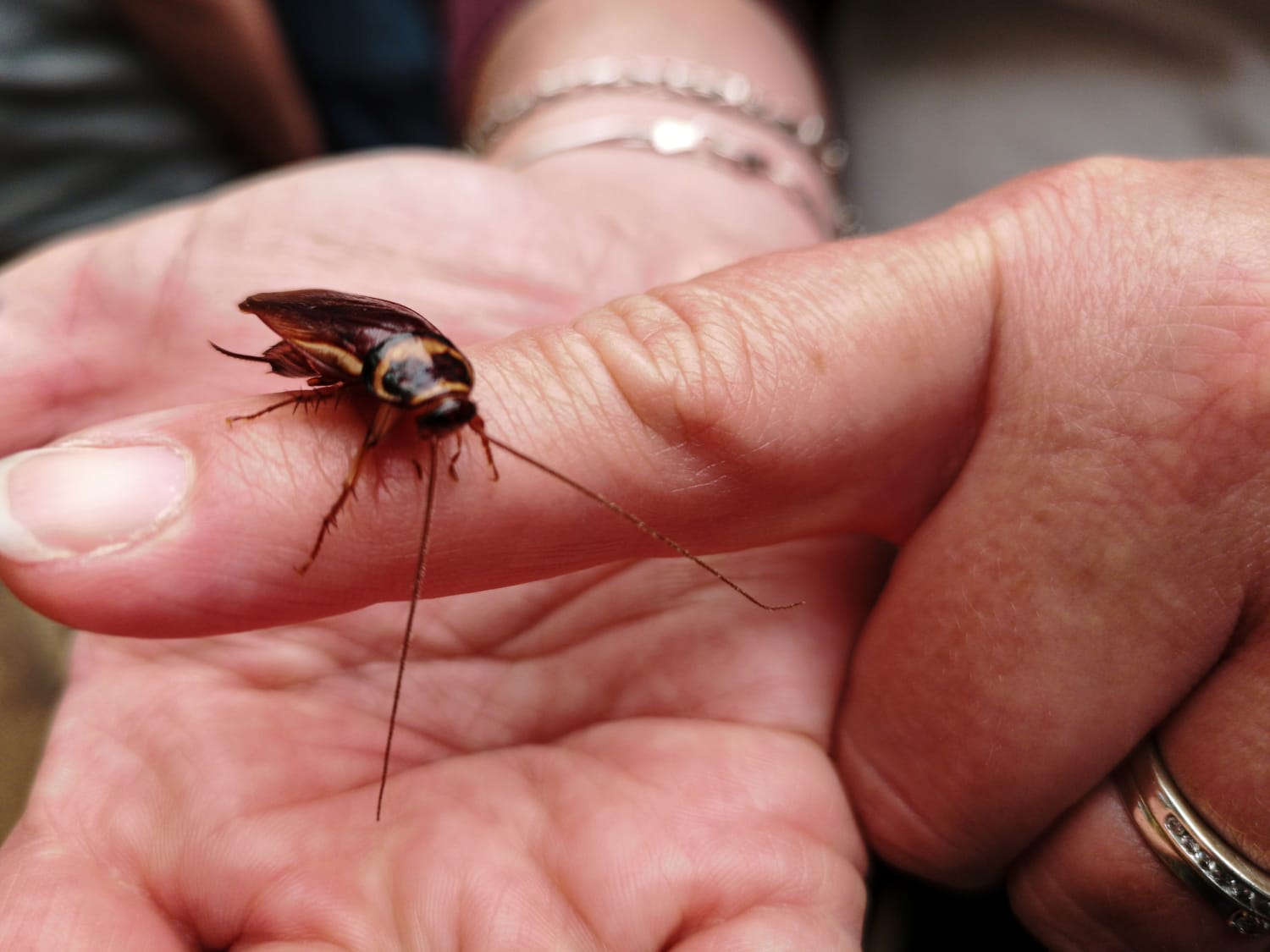 Extraen un pedazo de cera del oído de un hombre y lo que se ve parece una  cucaracha (VIDEO)