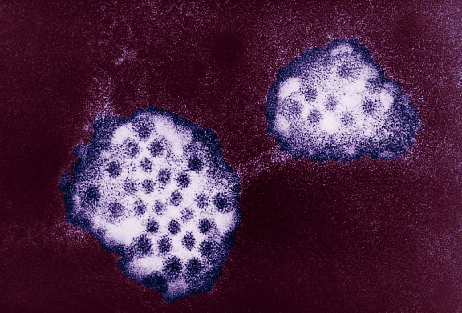 norovirus