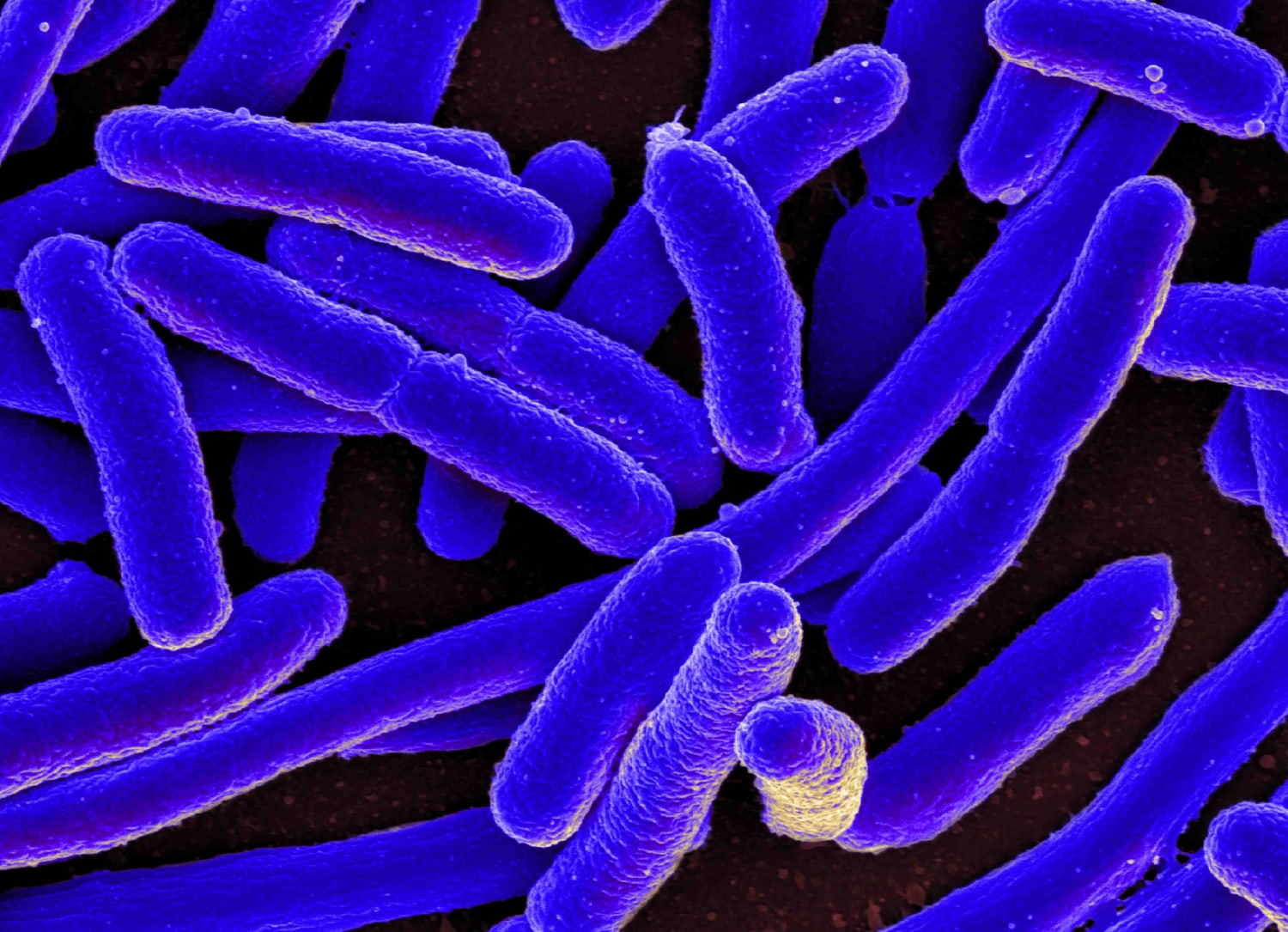 e coli bacteria