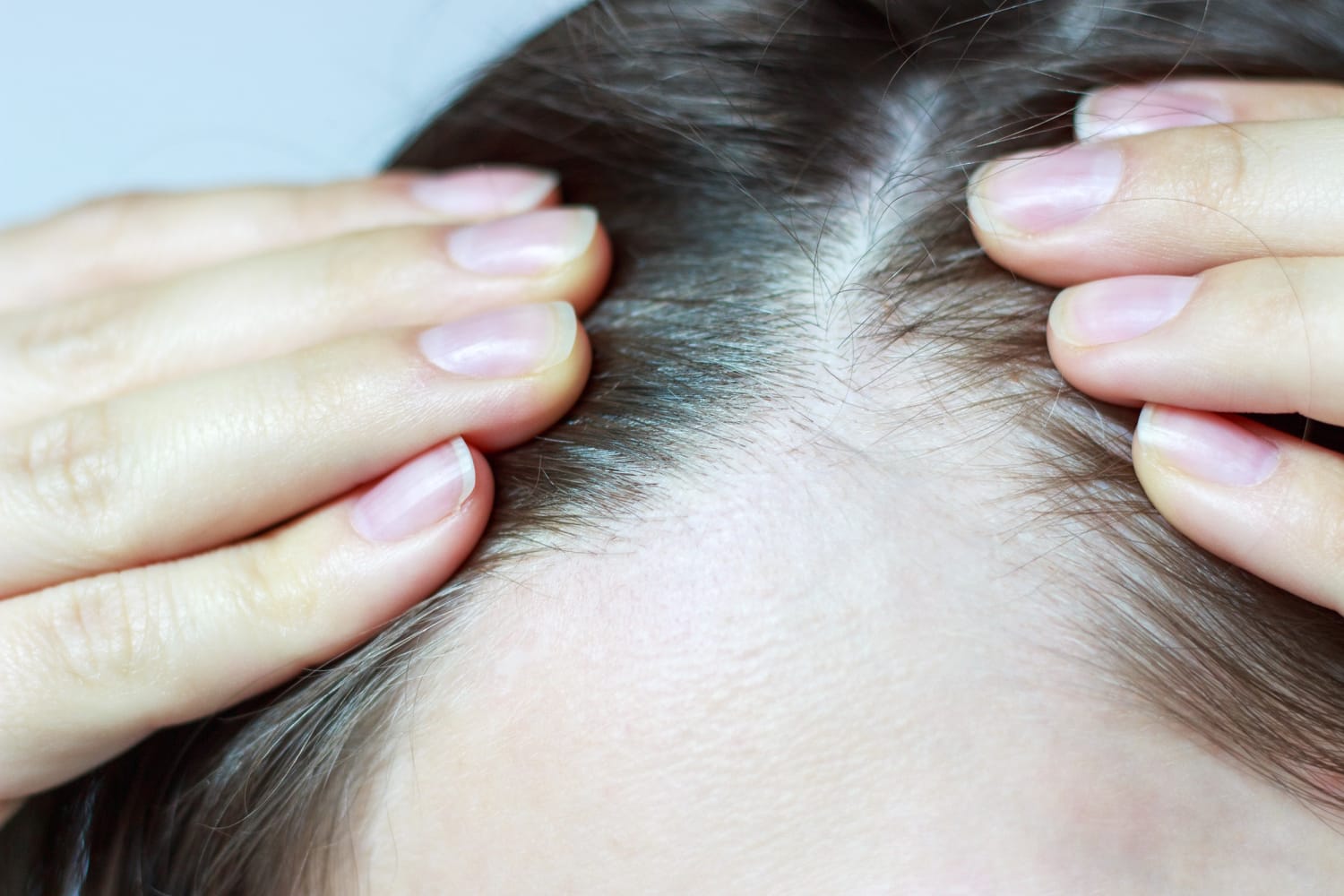 New Study Points to Possible Cure for Hair Loss