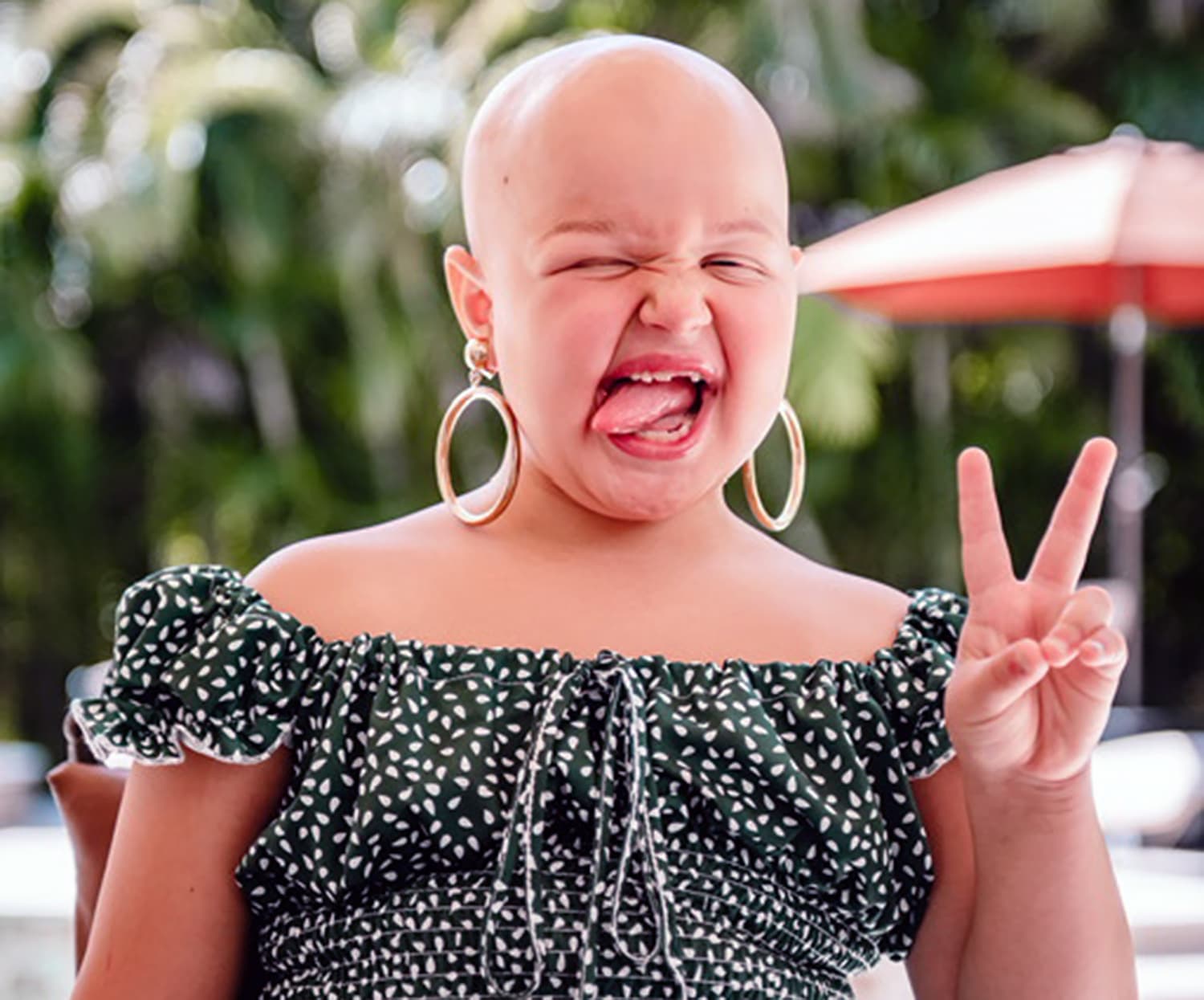 Meet the 4-year-old fashion designer with alopecia who's making