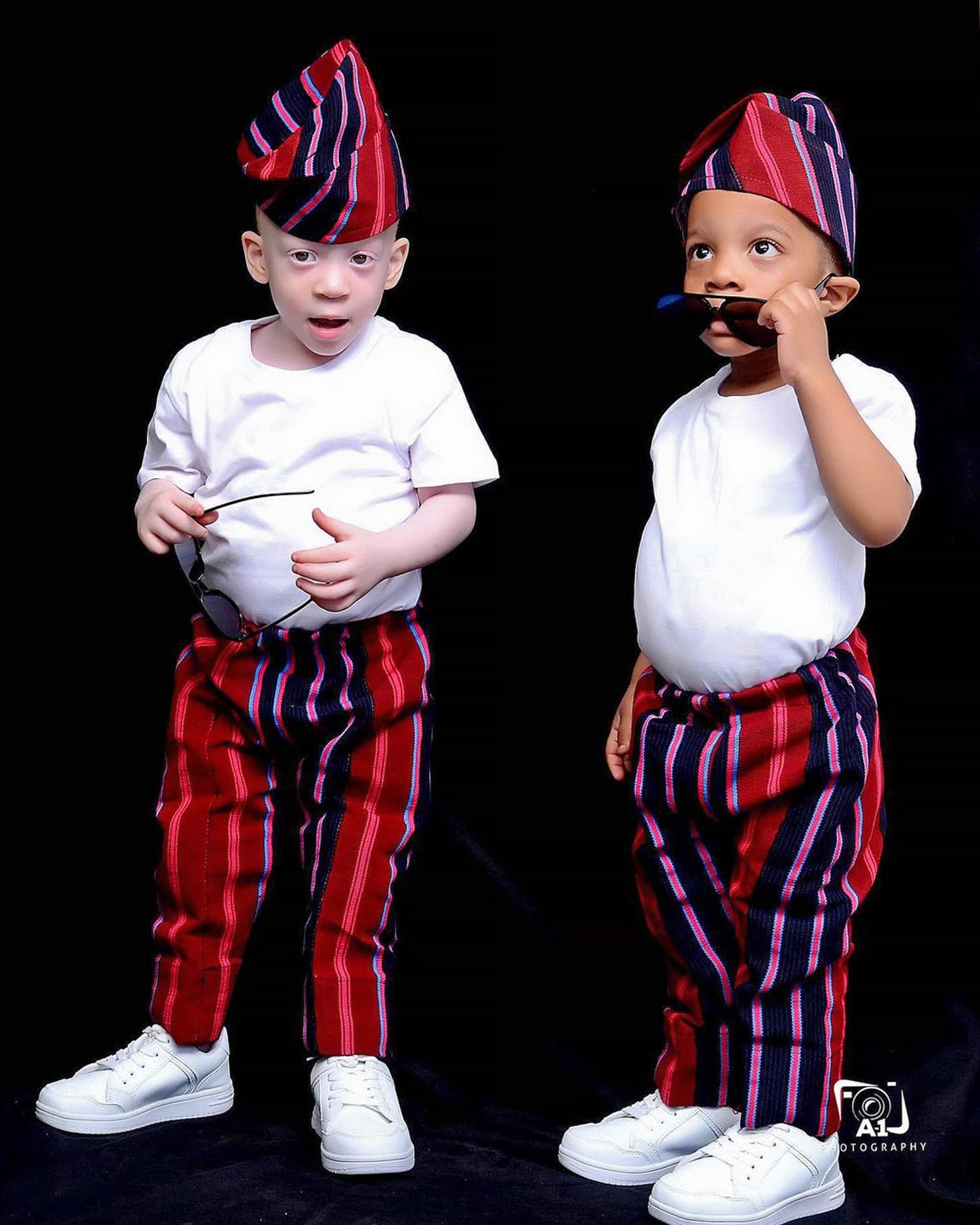 Twins - One With Albinism, One Without - Are Best Friends, image size:1500x1875
