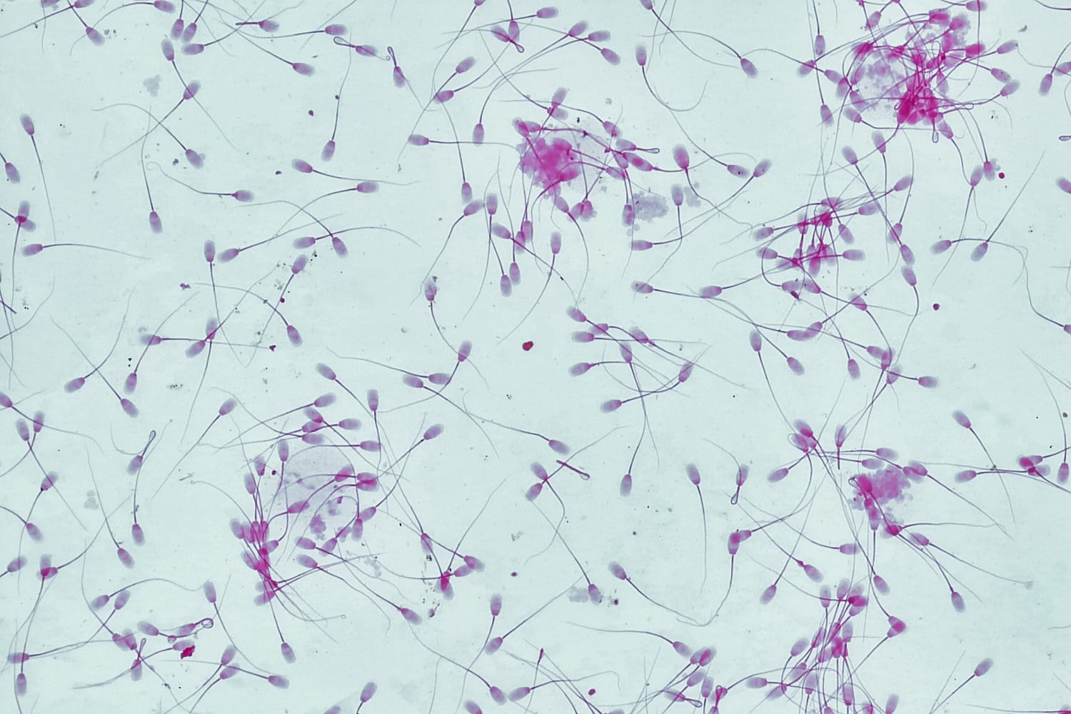 round cells in sperm