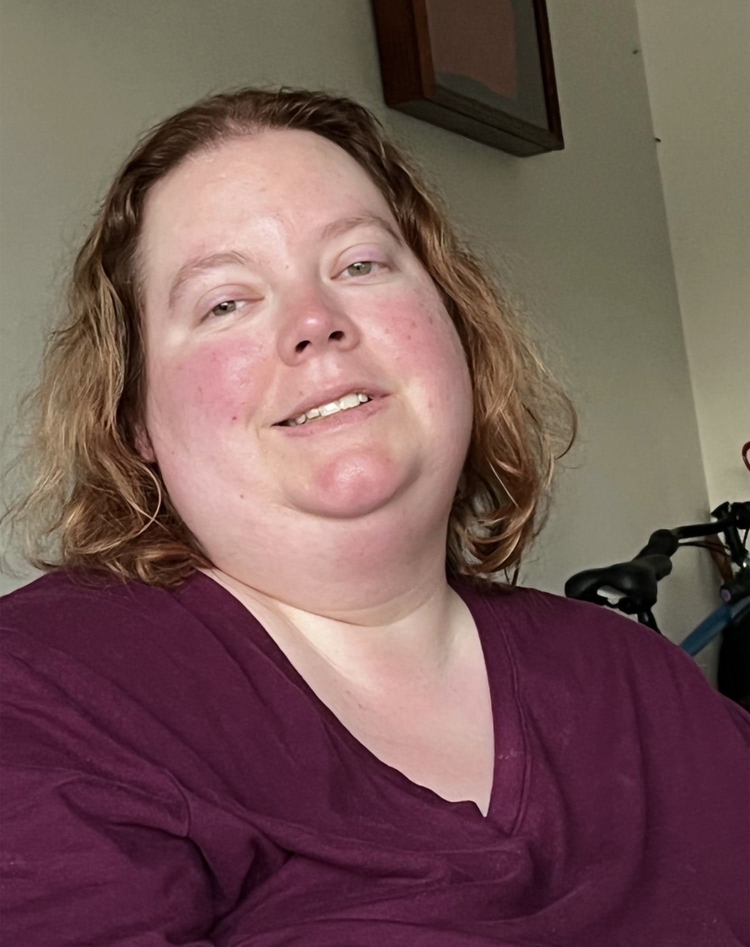 Mom Who Lost 200 Pounds Now Eyes Surgery for Loose Skin