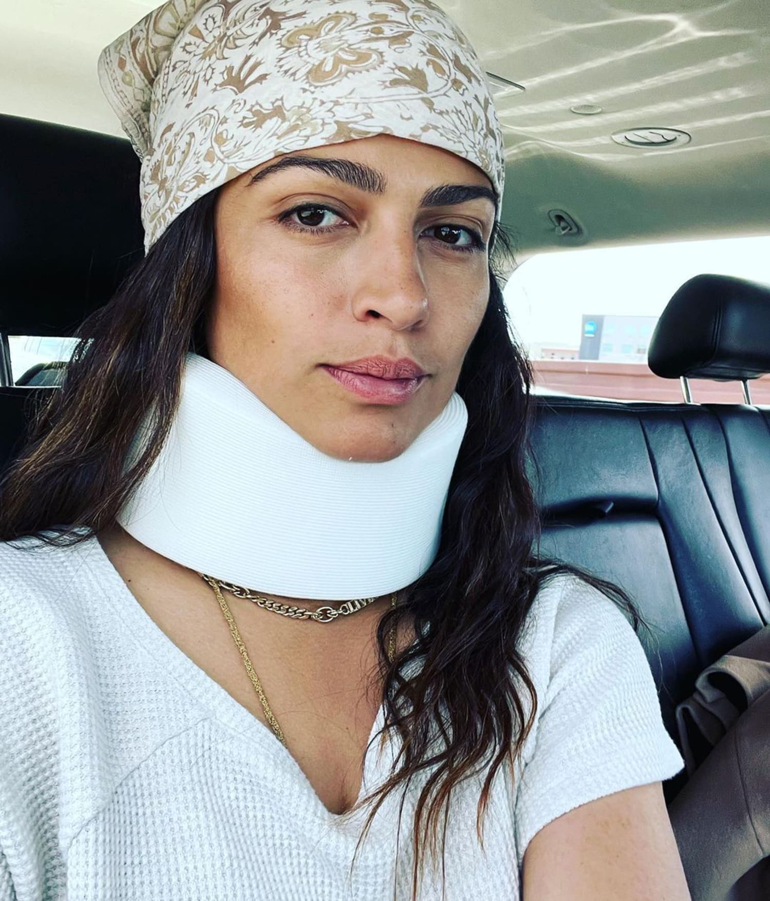 Camila Alves McConaughey Shares Pic of Neck Injury After Fall