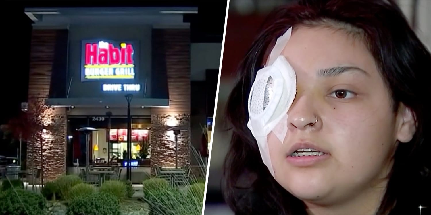 Fast-Food Worker Loses Eye Protecting Special Needs Boy