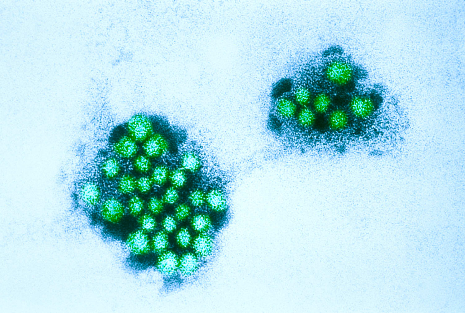 230209 Norovirus Annual High Kh 57749a 