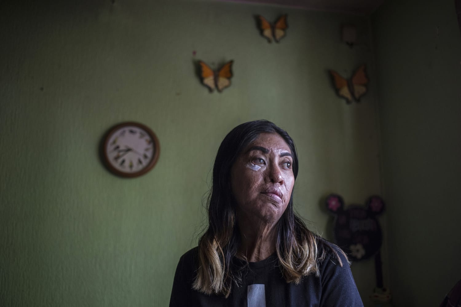 In Mexico, a state votes to toughen laws against femicides, acid attacks photo pic