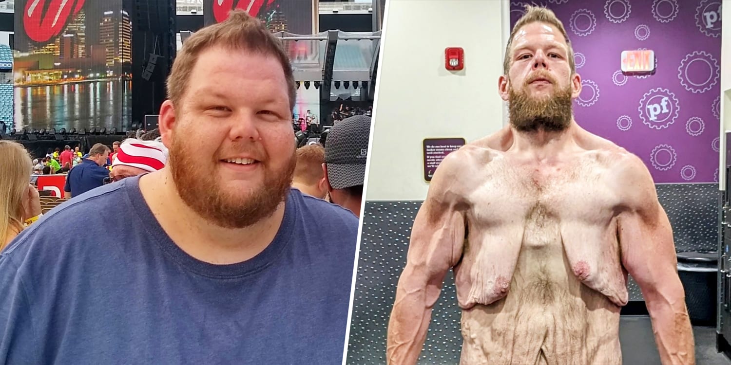 Man lost weight. Demonstration of result of how guy slim down