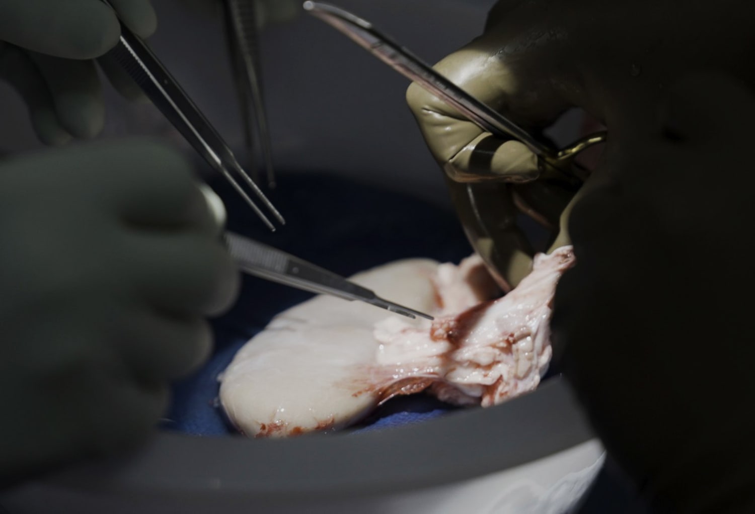 Gene-edited pig kidney keeps monkey alive for 2 years, trial finds