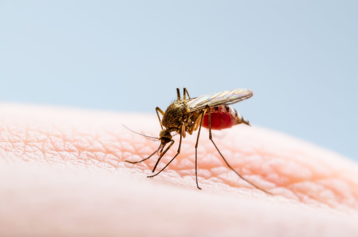 马里兰州报告了 40 年来首例本地获得性疟疾病例