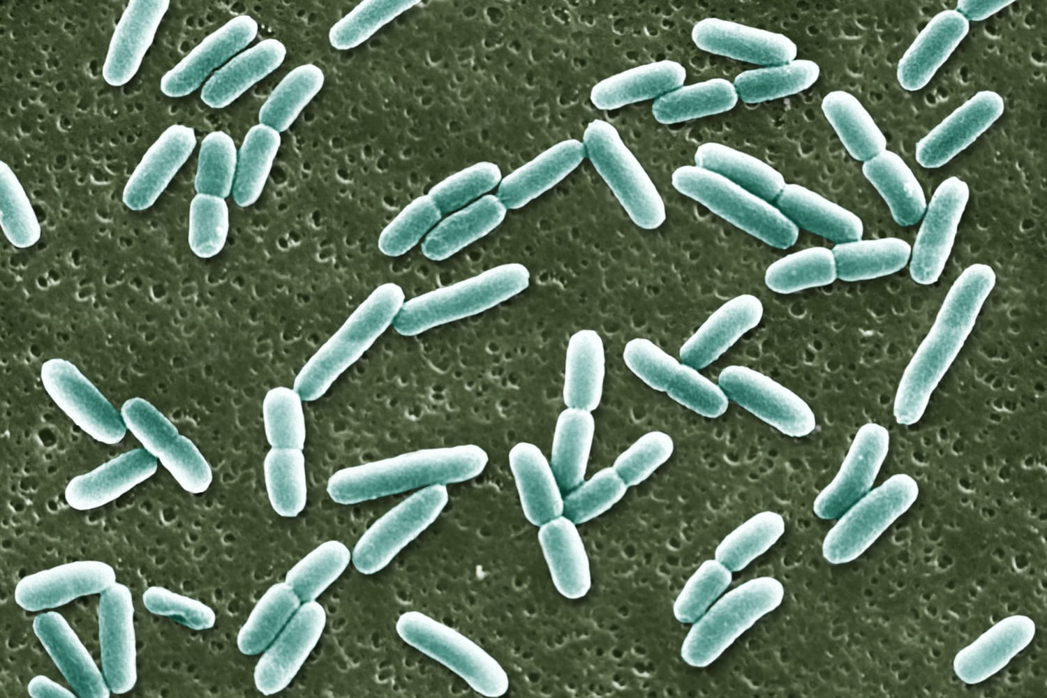 Escherichia Coli Microscope E Coli Under The Microscope Types 