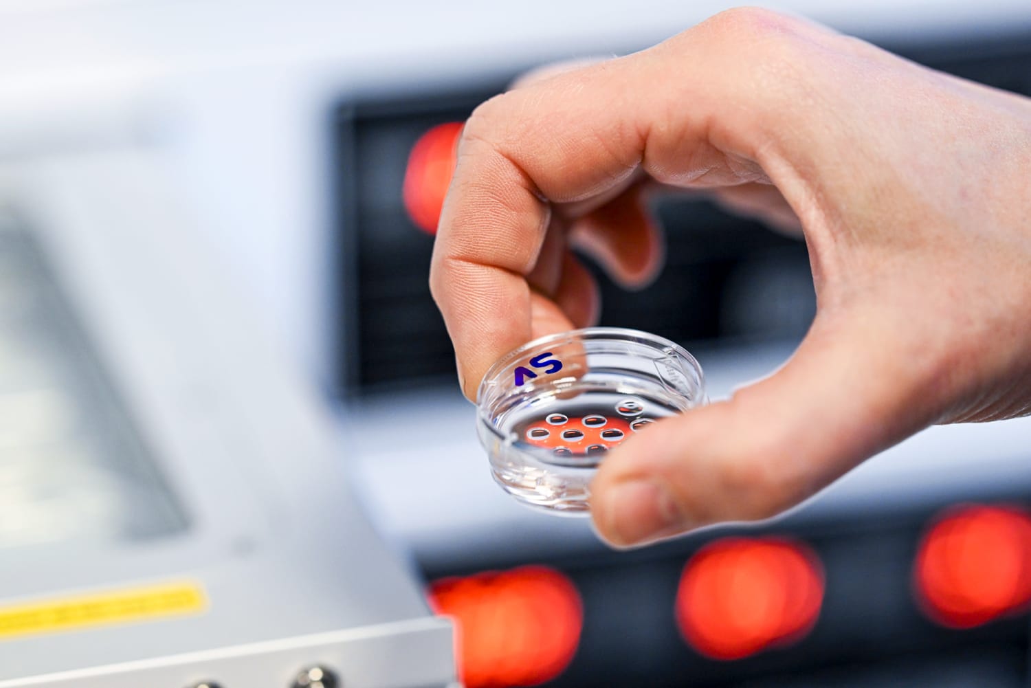 Pauses on embryo transfers out of Alabama leave IVF patients few options Pauses on embryo transfers out of Alabama leave IVF patients few options