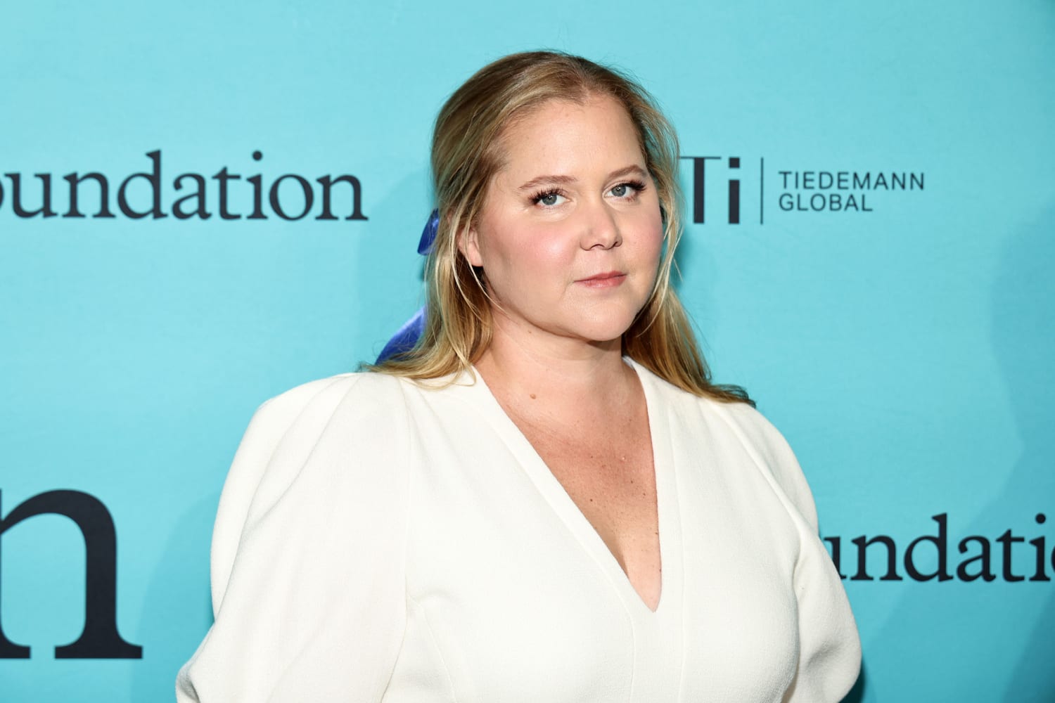 Amy Schumer Reveals She s Been Diagnosed With Cushing syndrome