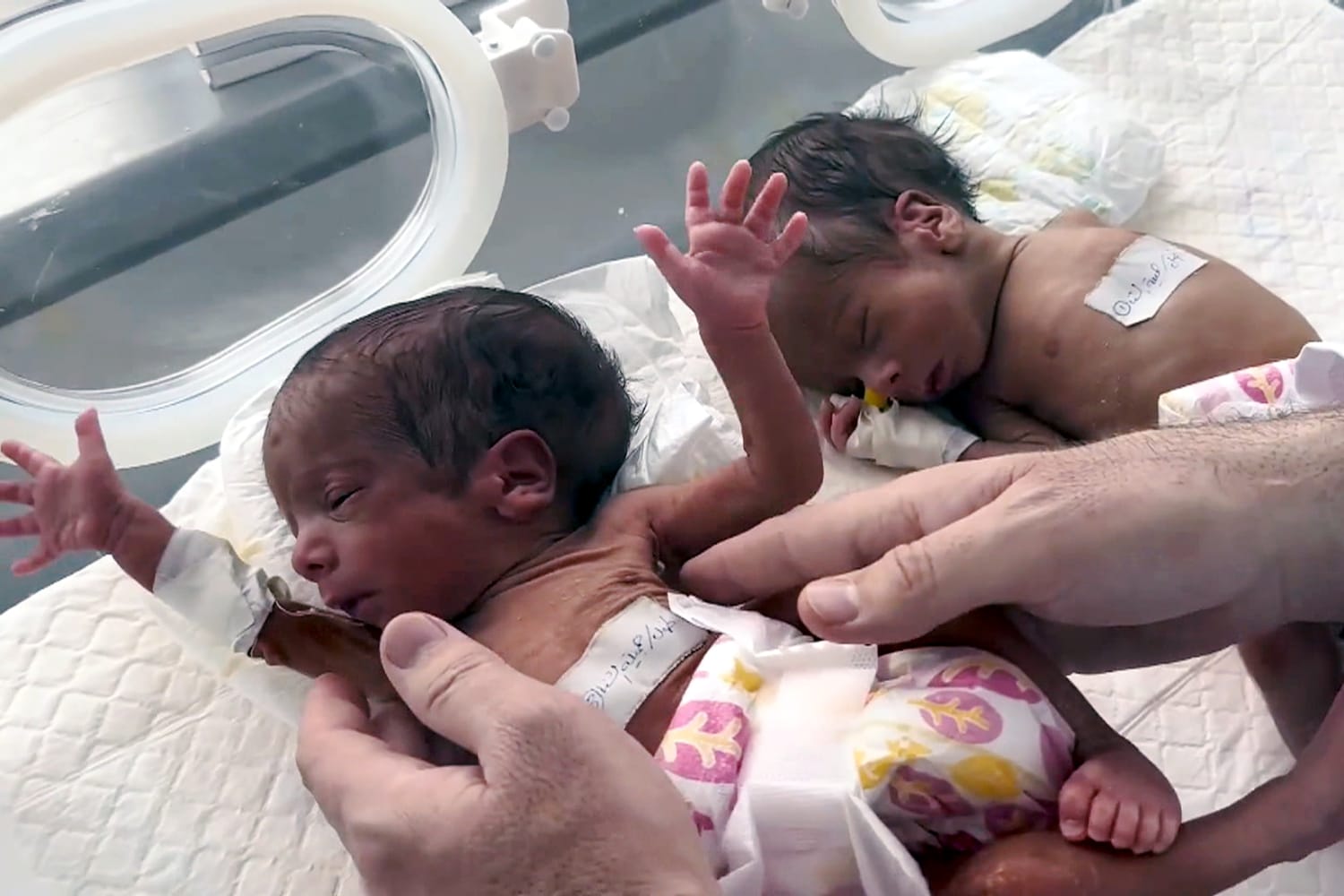 Two premature babies die from suspected dish soap contamination in Italy