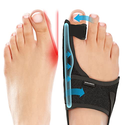Caretras Bunion Corrector