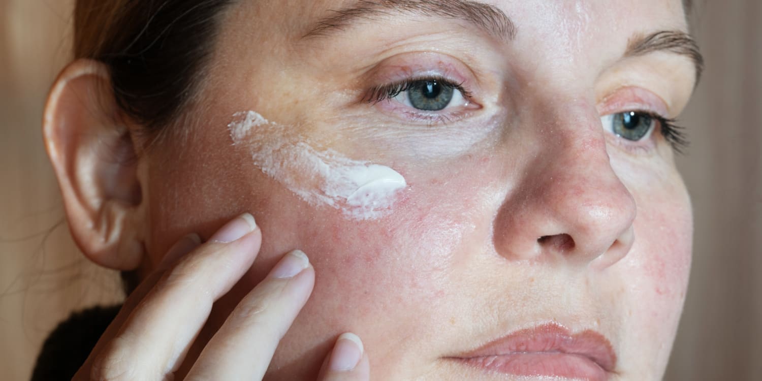 Azelaic acid cream
