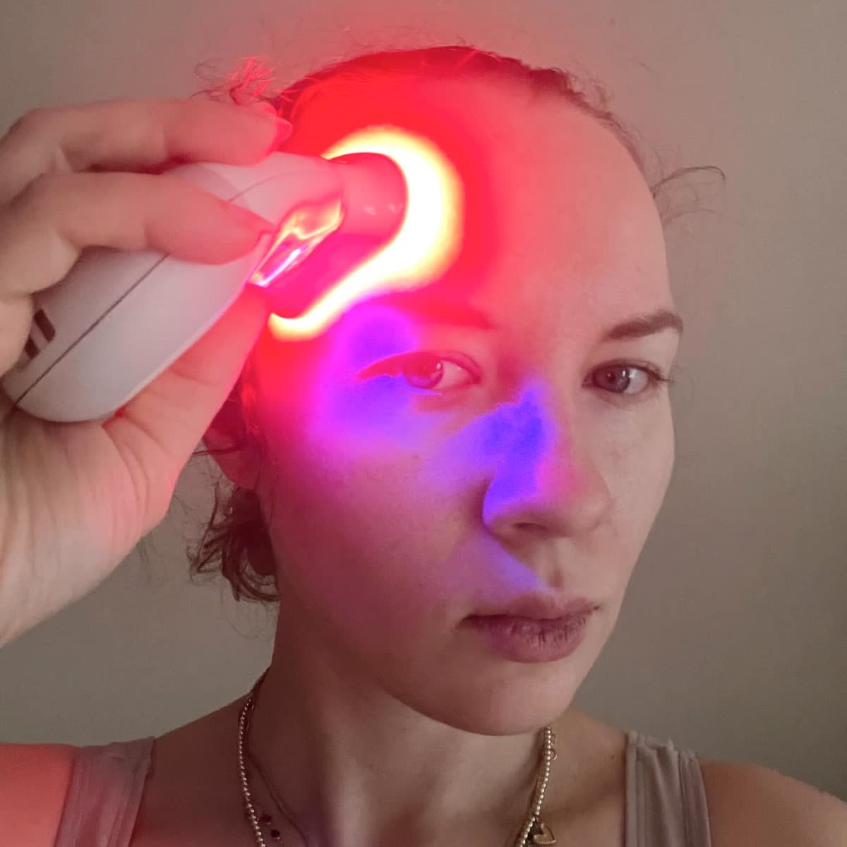 does red light therapy help acne scars reddit