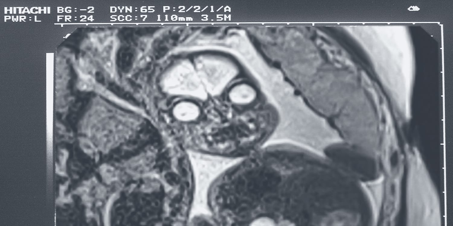 Baby or alien? Why fetal MRI images are so spooky