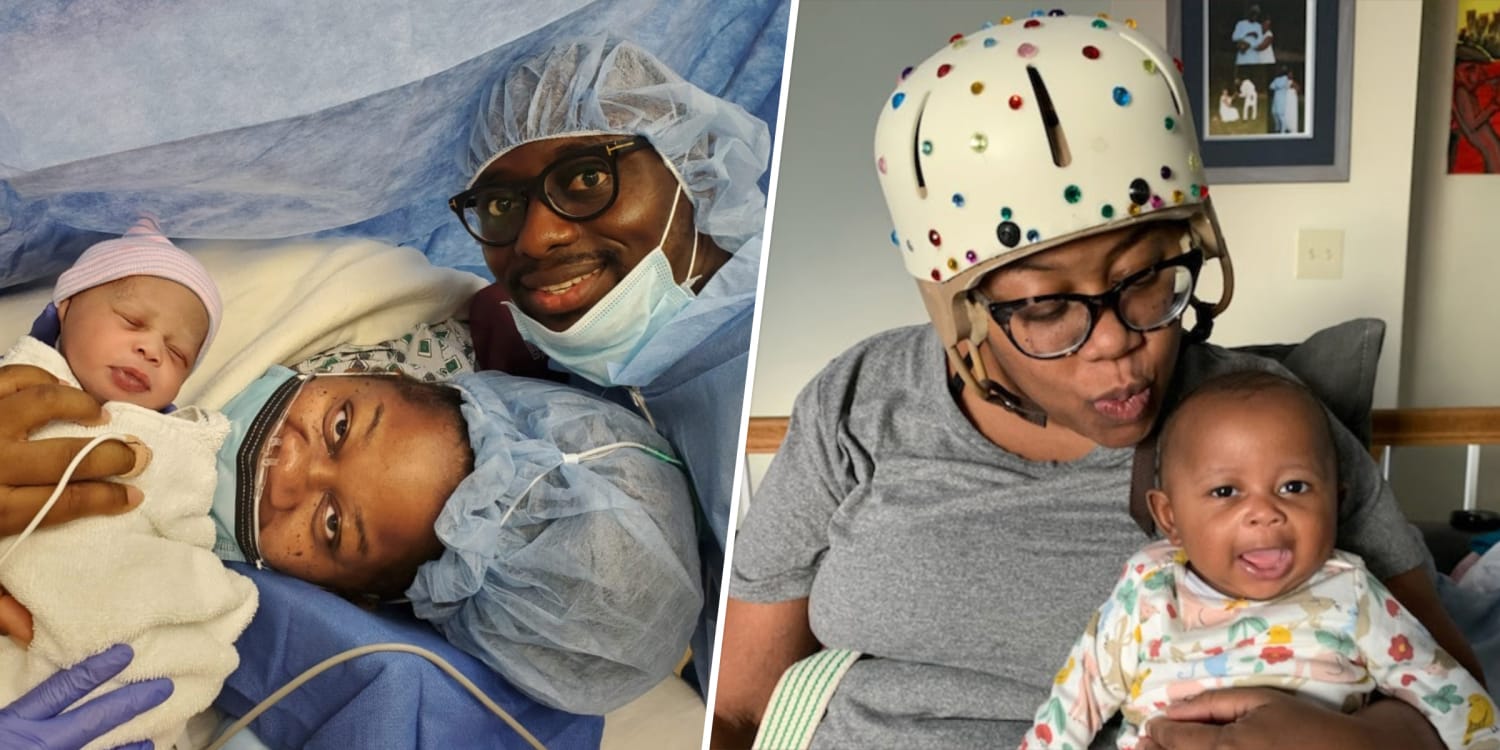 'Stroke Mama' reveals 2 brain bleed warning signs after giving birth